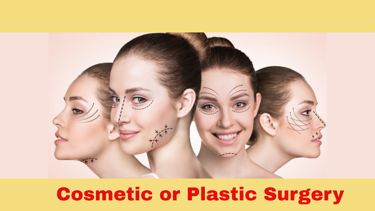 Cosmetic or Plastic Surgery