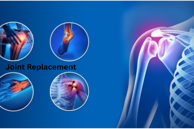 Which Hospital Is Best for Joint Replacement Surgery?