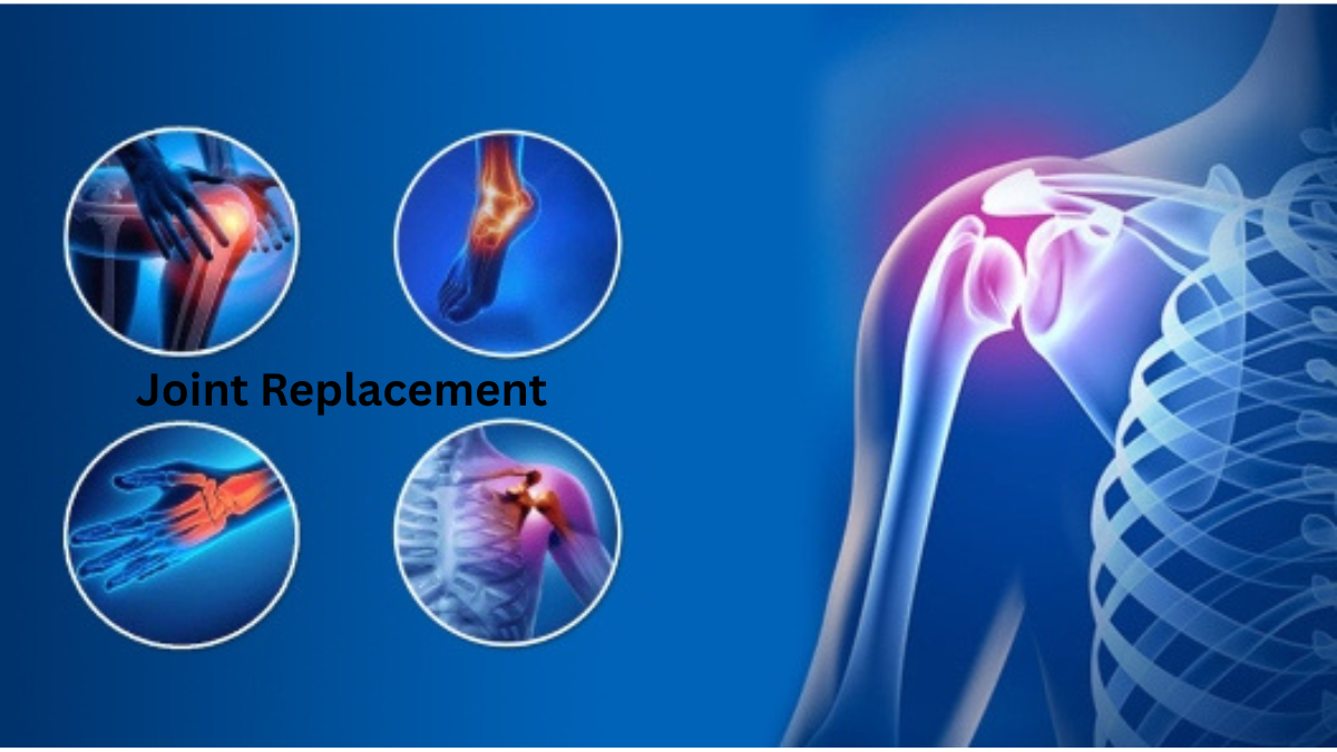 Joint Replacement