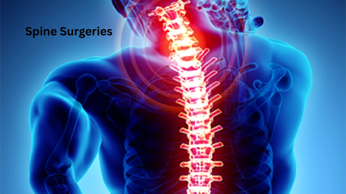 Spine Surgeries