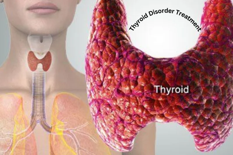 How to Find the Best Hospital for Thyroid Disorder Treatment?