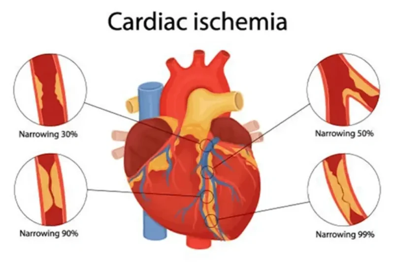 What Makes a Heart Hospital Reliable for Critical Cardiac Cases?
