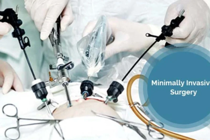 Where Can You Get the Safest Minimally Invasive Surgeries?