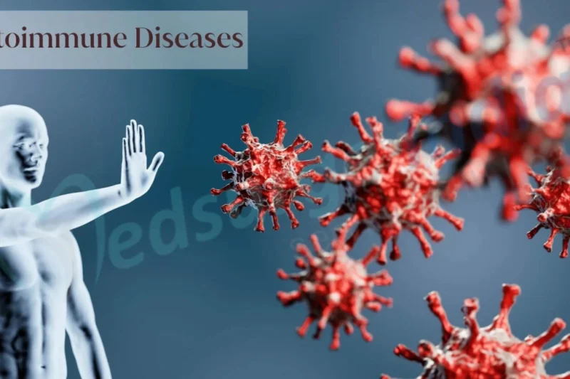 Which Hospital Provides the Best Care for Autoimmune Disorders?