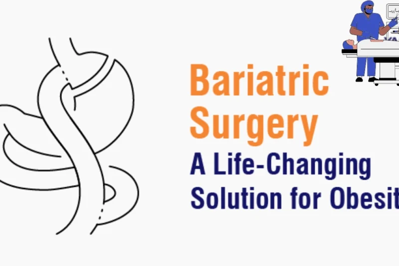 Where Can You Find the Top Bariatric Surgery Hospitals?