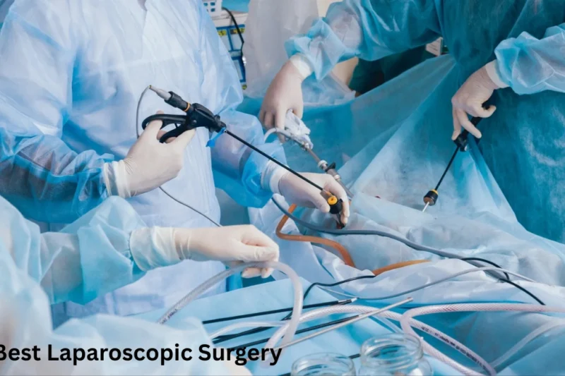 Where to Find Hospitals With the Best Laparoscopic Surgery Teams?