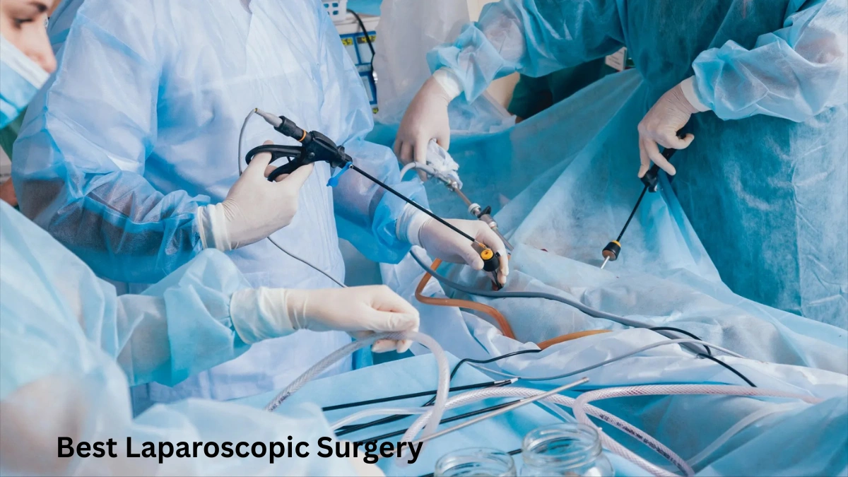 Best Laparoscopic Surgery